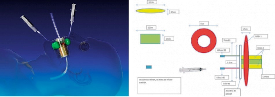 dispositivo inmovilizacion tubos administracion oxigeno pacientes anestesiados