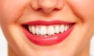 Protección dental ¿En qué consiste?