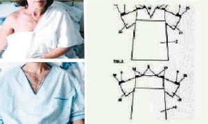 Camisón hospitalario