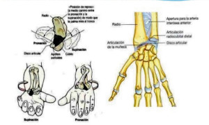 Implante Articulado Radio-cubital Distal