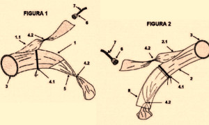 Prendas higiénicas